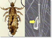 頭じらみ、毛じらみ